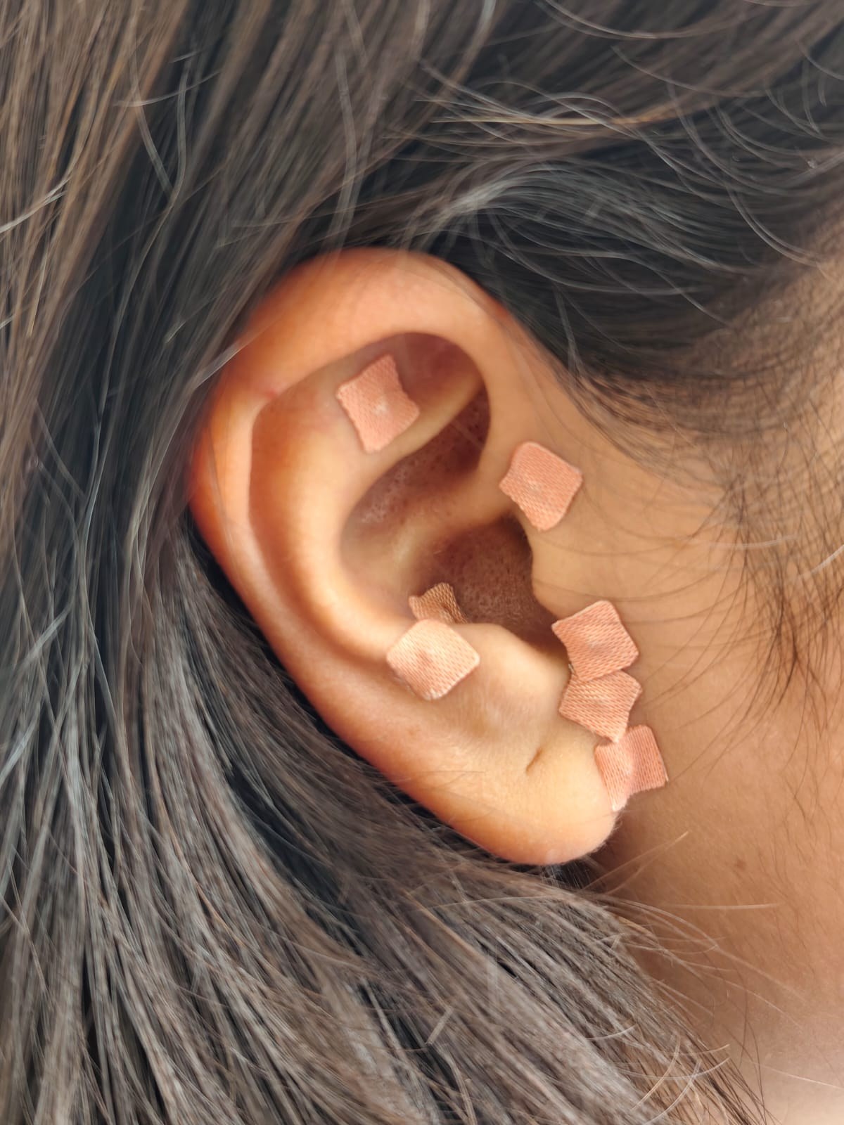 Sesión de auriculoterapia